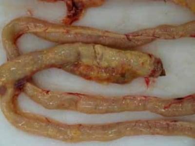 Slika 6. Ikterus, subserozni granulomi rektuma, kolona i ileuma